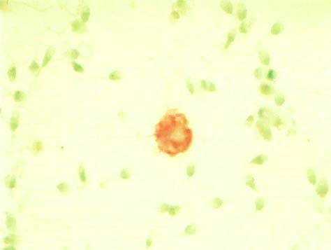 Figure 4: Pathological effects of ROS on spermatogenesis and function[13].