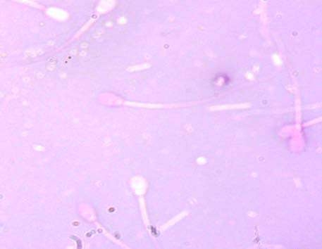 32. PetrunkinaAM, Dagmar WaberskiAR, Günzel-ApelE, Töpfer-Petersen. Determinants of sperm quality and fertility in domestic species. Reproduction (Cambridge, England) 134, 3-17, 2007. 33. Rajender S, Rahul P, Mahdi A. Mitochondria, spermatogenesis and male infertility. Mitochondrion 5, 419-428, 2010. 34. Rijsselaere T, Van Soom A, Tanghe S. New techniques for the assessment of canine semen quality: a review. Theriogenology 64, 706-719, 2005. 35. Schafer-Somi S, Aurich C. Use of a new computerassisted sperm analyzer for the assessment of motility and viability of dog spermatozoa and evaluation of four different semen extenders for predilution. Ani Reprod Sci 102, 1-13, 2007. 36. Sicherle CC, Souza FF, Freitas-Dell'Aqua CP, Mothé GB, Padovani CR, Papa FO, Lopes M D. Effects of the cryopreservation process on dog sperm integrity. Ani Reprod Sci 2020, 17: e20190081, 2020. 37. Silva PFN, Gadella BM. Detection of damage in mammalian sperm cells. Theriogenology 65, 958-978, 2006. 38. Stanger JD, Long V, Yovich JL, Almahbobi G.Hypoosmotic swelling test identifies individual spermatozoa with minimal DNA fragmentation. ReprodBiomedonline 21, 474-484, 2010. 39. Sutovsky P, Lovercamp K. Molecular markers of sperm quality. ReprodFertilSuppl. 67, 247-256, 2010. 40. Tang H, Duan C, Bleher R, Goldberg E. Human lactate dehydrogenase A (LDHA) rescues mouse Ldhc-null sperm function. BiolReprod 96, 1-6, 2013. 41. Thomas CA, Garner DL, DeJarnette JM, Marshall CE. Effect of cryopreservation on bovine sperm organelle function and viability as determined by flow cytometry. BiolReprod 58, 786-799, 1998. 42. Travis AJ, Kopf GS. The role of cholesterol efflux in regulating the fertilization potential of mammalian spermatozoa. J Clin Invest110, 731-736, 2002. 43. Veznik Z, Svecova D, Zajicova A, Prinosilova P. Functional evaluation of dog ejaculates with a priority aspect of acrosome integrity. Vet Med 48, 221-228., 2003. 44. Volpe S, Leoci R, Aiudi G, Lacalandra GM. Relationship between motility and mitochondrial functional status in canine spermatozoa. Reprod Dom Ani 44 (Suppl. 2), 275-278, 2009.