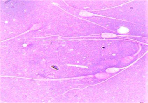 A) Live (white) and Dead (pink) spermatozoa Effect of Cryopreservation on Biological Markers of Sperm Function and their Correlation in Different Dog Breeds Spermatozoa with straight tail (a) andcoiled tail (b) (C) Green, yellow, orange-red fluorescence on mid piece indicate low, medium and high inner mitochondrial membrane potential.