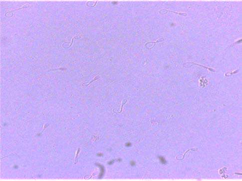 Fig. 1: Viability: Eosin-nigrosine staining (A), plasma membrane integrity: Hypo-osmotic swelling test (B)and Inner mitochondrial potential: JC-1 (C) in canine spermatozoa.