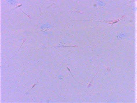 Fig.6: Inner membrane mitochondrial membrane potential (IMMP). high IMMP (HIMMP) and medium IMMP (MIMMP).