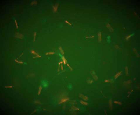 Fig. 7: Effect of incubation of spermatozoa in canine TALP medium on induced in vitro acrosome reaction.