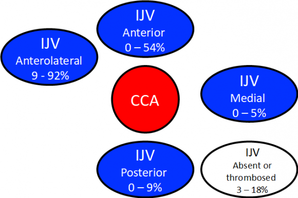 Relationships of the internal jugular vein (IJV) with the sternocleidomastoid muscle (dashed line) and of the subclavian vein with the clavicle (dotted line).