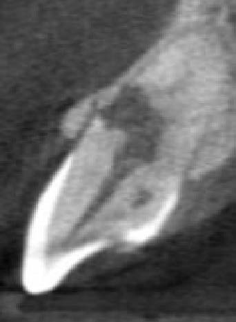 Figure 2: Growth kinetics of Tetrahymena thermophila and Tetrahymena pyriformis in artificial saliva and PPYE medium during 7 days of culture. Absorbance was determined at 600nm every 24 hours of growth. A.S: Artificial salivaResults of the viability analysis in the twoTetrahymena species after 48h, 96h and 168h of culture do not show any significant differences between the artificial saliva and the PPYE medium (Figure3).
