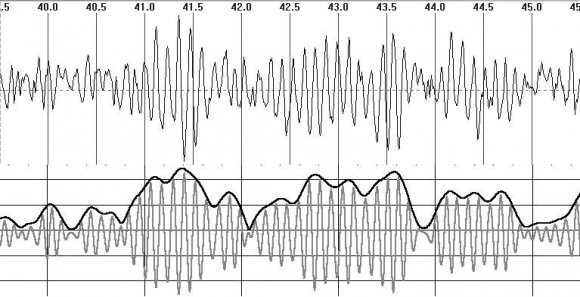 Fig. 2: The three topogramms of EEG synchrony of chosen subject for standard grid of channels depending on correlation value r xy : a -r xy >0.2; b -r xy >0.6; c -r xy >0.8; d -profile of synchrony for chosen subject: vertical axis -correlation values; horizontal axis -the nearby pairs of derivations ordered from left to right and from top to down according to its arrangement on a scalp.