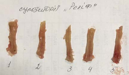 Figure 3: Influence of PUFAs concentrate "BIOIL" on macroscopic characteristics of experimental proctitis.? -colon of animals from the control group. Large areas of necrosis, hemorrhage and edema of the mucosa. B -colon of animals that received PUFAs concentrate "BIOIL" in combined mode (intragastric and rectal). Necrosis and hemorrhage are absent, normal mucosa. C ? colon of animals that received suppositories "Relief". Mucosa of the colon without any visible signs of damage.IV.