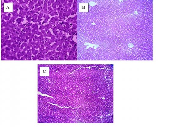 Figure 1 : a) Transverse section of the liver of normal control rats, showed normal hepatic cells with well preserved cytoplasm, prominent nucleus and nucleolus and central vein. b) Transverse section of the liver of CCl (0.5 ml/kg) treated animals showing disarrangement and degeneration of normal hepatic cells with lobular necrosis, vacuole formation and fatty change. CV: Central vein; HC: hepatocytes; SS: Sinusoidal space; c)Transverse section of the liver, after simultaneous treatment of Embryonic Stem cells and CCl treated animal' s shows regeneration of hepatocytes, less vacuoles, disarrangement of fatty change compared to hepatotoxin.