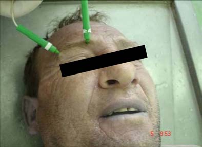 Fig. 4 : Digital Thermometer