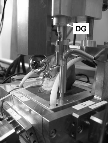 Fig. 3 Strain gauge. The aluminum plate onto which the strain gauge was pasted was inserted in the cement through the proximal posterior hole in the composite femur. The displacement of the aluminum plate represented the longitudinal displacement on the cement. A, aluminum plate; B, composite femur; C, cement; G, strain gauge; S, stem.