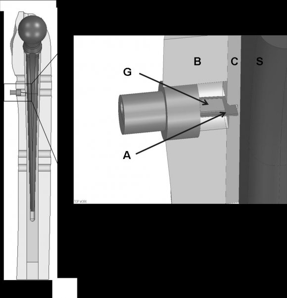 Fig. 6A-B Radiographs of aluminum plates obtained after the experiment. (A) Polished stem. Less deformity of the aluminum plate was seen. (B) Rough stem. The aluminum plate was bent distally.