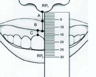 Figure 6 : Top View of Oral Cavity (mm)
