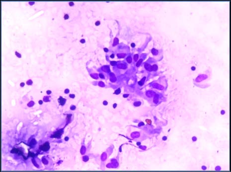 was used as indicator strain for phage isolation. After enrichment, phage containing samples were placed on semisolid LB medium with P. aeruginosa forming lawn. Two phages were isolated that ranged from 3 to 4 mm in diameter on lawn of indicator strain by plaque analysis (Fig2). These phages were isolated from sewage water, the same reservoir as their host. Later experiments showed that the observed plaques of two phages were similar in all aspects. Purified phage produced clear plaques on lawn of host bacterium P. aeruginosa (Fig3).
