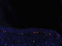 v 9.1 (SAS Institute Inc., Cary NC). The sample size of 15 patients per study segment Journals Inc. (US)