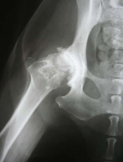 a) fMRI results fMRI was performed in 12 patients, including finger movement of hands, the flexion and extension of toes and tongue movement, and 100% of the precentralgyrus was activated. All the activated Volume XIV Issue II Version I © 2014 Global Journals Inc. (US)