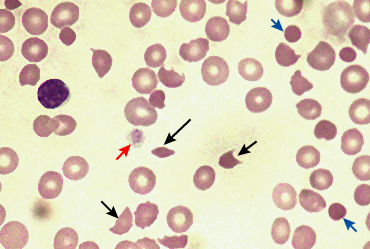 MD was the principal researcher and prepared the first draft of the report.