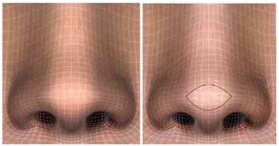 Figure 7 : Diagram indicating possiblevariations of nose tip types considering the variables:domal divergence angle and domal wideness according to Gunter