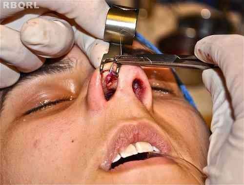 Figure 21 : Pre-operative anterior view