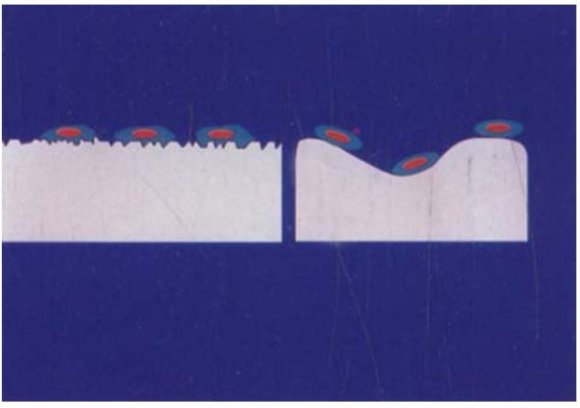 Figure 6 : Schematic diagram showing the effects of rough microtopography on production of paracrine factors by osteoblasts during peri-implant bone formation. Osteoblasts synthesize osteoid on the implant surface as well as on the normal bone surface. Levels of latent TGF-?1 are increased in the extracellular matrix, as well as in the extracellular fluid. Once activated, the growth factor can stimulate osteoblast proliferation, extracellular matrix synthesis and alkaline phosphatase activity (+). At the same time, active TGF-?1 inhibits osteoclastic activity (-). Osteoblasts also produce elevated levels of 1,25 dihydroxyvitamin D 3 (1,25(OH) 2 D 3 ) on rough surfaces. 1, 25(OH) 2 D 3 promotes osteoclast formation due to fusion of monocytes and acts on osteoblasts promoting their differentiation. 1?, 25(OH) 2 D 3 also stimulates matrix calcification through rapid activation of Ca2+ ion deposition b) Surface Ultrastructure