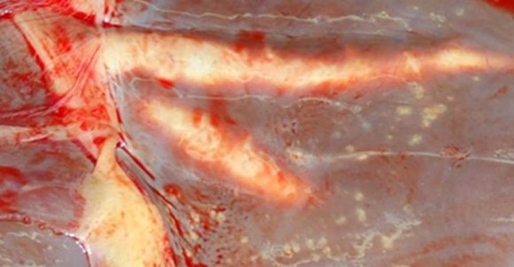 Figure 1 : Chronic liver fluke infection in cattle, with bile duct distension (Gross)The histopathological changes observed in this study showed both parenchymal and biliary tract lesions. Fibroblasts admixed with lymphocytes, plasma cells and few macrophages in the area previously migrated by the young fluke in cattle and sheep liver parenchyma with mild portal fibrosis (figure. 2B) and biliary hyperplasia were lesions repeatedly examined in chronic cases. Histologically, in chronic infection there was no differences between lesions of co-infected and, fasciola and fasciola indicative lesion positive livers. Atrophy, fatty necrosis, focal and multi focal hepatonecrosis, peribiliary epithelial inflammation and biliary tract fibrosis with severe hyperplasia of the epithelial layer and mild liver parenchymal necrosis were also examined in some cases of chronic fasciolosis. Periacinar necrosis, cholangitis dominated by mononuclear cell infiltration, hepatocyte pyogranuloma, and portal fibrosis and cirrhosis with fibrous connective tissue were also encountered in some cattle and sheep livers though fibrosis was less severe in sheep. One liver taken from cattle showed multilobular parenchymal fibrosis with large amount of fibrin in the portal area and complete biliary cirrhosis. Granuloma lesion with aggregation of epitheloid cells and mononuclear cells, intrahepatic ductular fibrosis surrounded by normal area, portal fibrosis with mononuclear cell infiltration and lymphocytic multifocal hepatitis were also examined. On the other hand, focal coagulative hepatocyte necrosis, fatty degeneration, portal fibrosis with mild biliary hyperplasia and peri-acinar necrosis were histopathologic changes observed in chronically