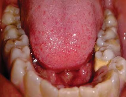 Figure5: Scheme of the spotting of some of the bacterial internal structures of interest according to different dimensional scales (nanoparticles, vesicles, vesicles' membrane, bacterial plasmatic membrane). This schematization, carried out through visual analysis and mixing of Figs.3, 6 and 8(the last two at a higher magnification), proves the existence of a continuum of vesicles from the ruffle to the whole cell