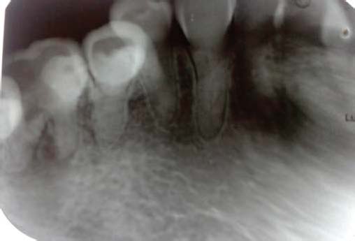 Figure 9 : Same image as in Fig. 8 rielaborated with GIMP in order to better display internal vesicles