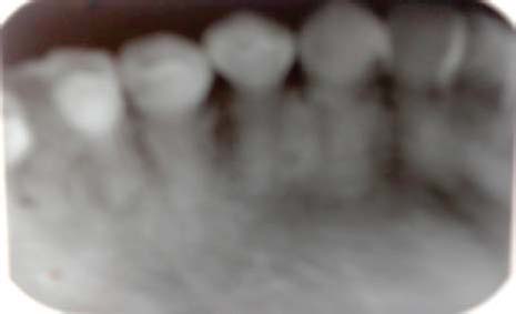 , A. (2010) " Evolution: Bacterial endocytosis uncovered ", Nature Reviews Microbiology, vol. 8. 39. Lowy, F. D. (2000) " Is Staphylococcus aureus an intracellular pathogen?", Trends in Microbiology, vol. 8, pp. 341-343. 40. Malani, P. N. (2014) " National burden of invasive methicillin-resistant Staphylococcus aureus infection ", JAMA, vol. 311, pp. 1438-1439.