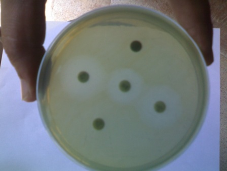 Figure 4 : ?-hemolysis on blood agar Figure 5 : Antibiogram on Nutrient agar On Gram's staining, the bacteria appeared Gram-negative, pink colour, medium size bacilli. Biochemical examination revealed battery of reactions characteristic to Pseudomonas aeruginosa. Based on the zone of inhibition, observations of drug sensitivity tests revealed resistance against amoxicillin+clavulanic acid, enrofloxacin, ofloxacin, levofloxacin, intermediate sensitivity to penicillin, gentamicin and tylosin, and sensitivity to amikacin, ceftriaxone+tazobactum and cefotaxim (Figure 5). The present findings were comparable to the studies conducted by previous researchers (Sun et al., 2011; Ohnishi et al., 2011; Mudau et al., 2013). On the basis of present findings