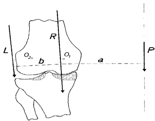Figure 17 : Moving the resultant R (MAQUET)