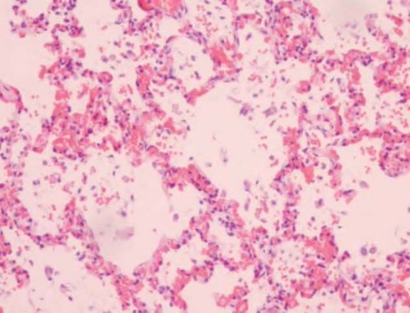 indoor testing of water damaged homes offer some insight. Bench testing of agar plates with growth of Stachybotrys, Cladosporium, Penicillium and Aspergillus