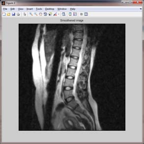 Figure 6 : Relation between properties of Lumber IVDs