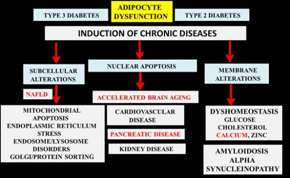 Figure 3 : Induction of pancreatic disease, NAFLD and neurodegenerative implicate LPS, dietary fat and alcohol consumption as factors involved in systemic inflammation. LPS alter hepatic lipid metabolism and adipocyte function with an increase hepatic cytokines and acute phase reactants (APP) that lead to pancreatic disease and neurodegeneration.