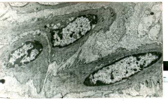 Figure 4 : Electron micrograph of smooth muscle cell of a bull (x 8000). In nuclei can be seen condensed chromatin (heterochromatin) and decondensed chromatin (euchromatin)
