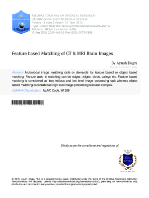 Feature Based Matching of CT 