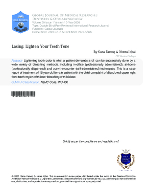 Lasing : Lighten Your Teeth Tone