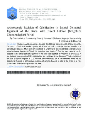 Arthroscopic Excision of Calcification in Lateral Collateral Ligament of Knee with Direct Lateral (Bengaluru Chandrashekar) Portal