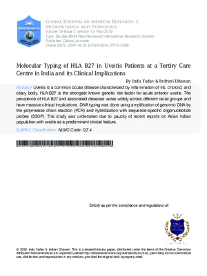 Molecular Typing of HLA B27 in UVEITIS Patients at a Tertiry Care Centre in India and its Clinical Implications