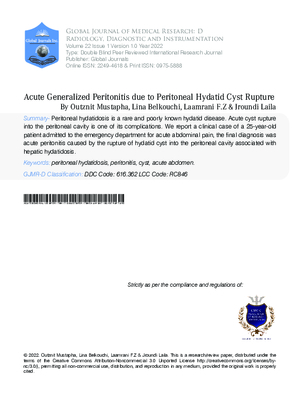 Acute Generalized Peritonitis due to Peritoneal Hydatid Cyst Rupture