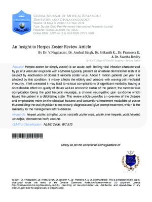 An Insight to Herpes Zoster : Review Article