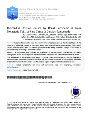 Pericardial Effusion Caused by Renal Carcinoma of Clear Metastatic Cells: A Rare Cause of Cardiac Tamponade