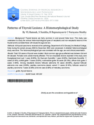 Patterns of Thyroid Lesions : A Histomorphological Study