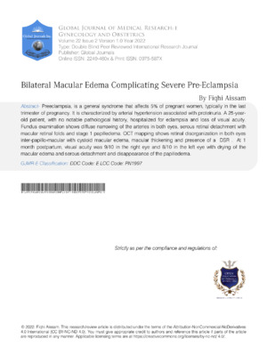 Bilateral Macular Edema Complicating Severe Pre-Eclampsia