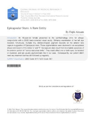 Epicapsular Stars : A Rare Entity