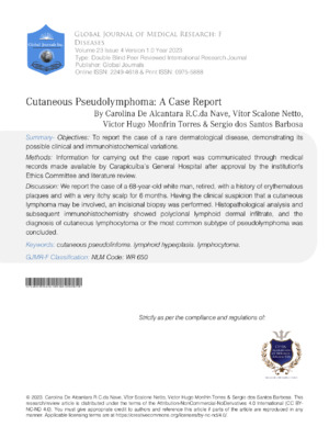 Cutaneous Pseudolymphoma: A Case Report