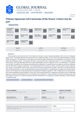 Primary Squamous Cell Carcinoma of the Breast: Diagnostic Challenges and Therapeutic Insights From a Rare Case