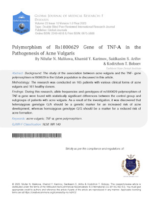 Polymorphism of Rs1800629 Gene of TNF-α in the Pathogenesis of Acne Vulgaris